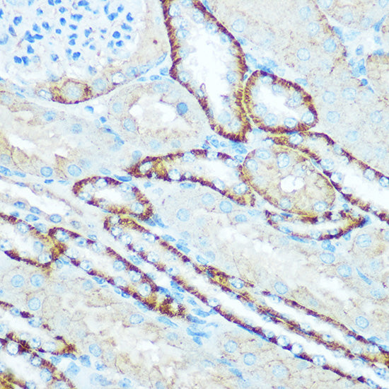 ATP5H Rabbit pAb