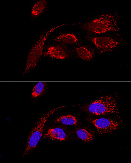 ATP5H Rabbit pAb