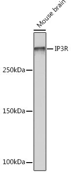 IP3R Rabbit mAb