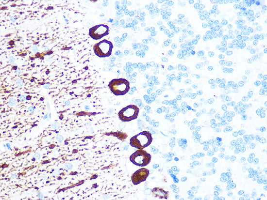 IP3R Rabbit mAb