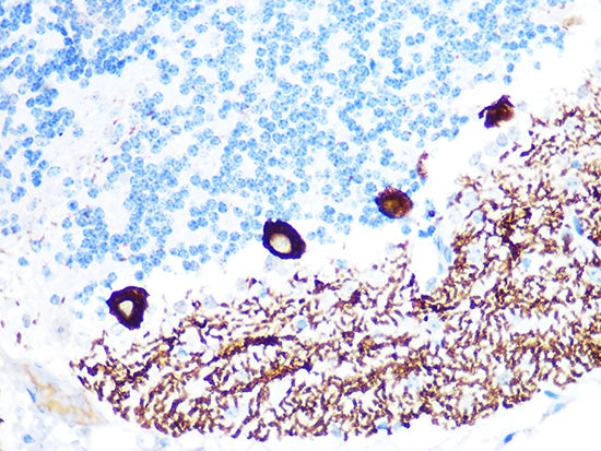IP3R Rabbit mAb
