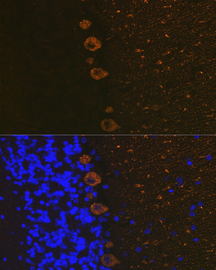 IP3R Rabbit mAb