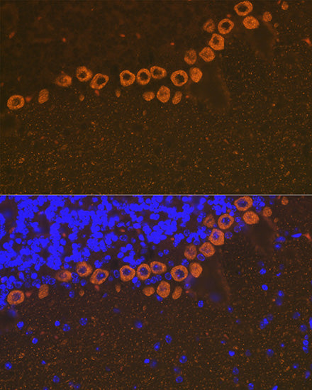 IP3R Rabbit mAb