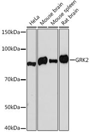 [KO Validated] GRK2 Rabbit mAb