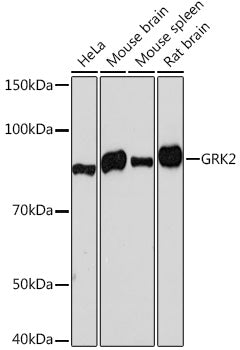 [KO Validated] GRK2 Rabbit mAb