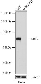 [KO Validated] GRK2 Rabbit mAb