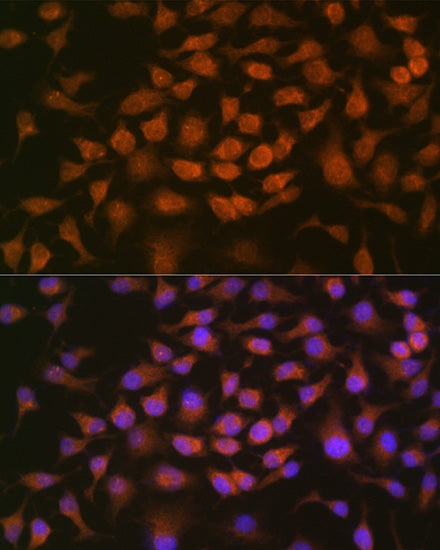 [KO Validated] GRK2 Rabbit mAb