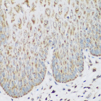 IGF2BP3 Rabbit pAb