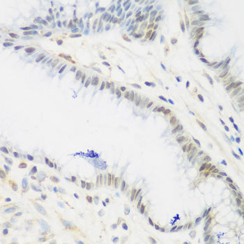 IGF2BP3 Rabbit pAb