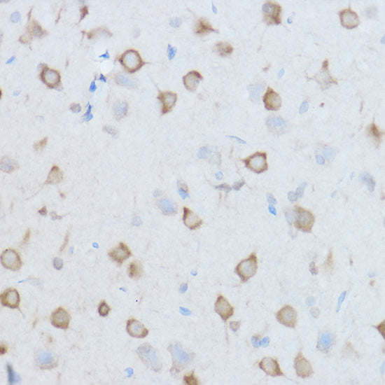 CCT8 Rabbit pAb