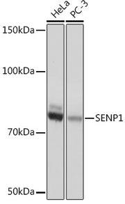 SENP1 Rabbit mAb