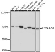[KO Validated] PEPCK/PCK2 Rabbit mAb