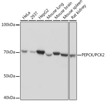[KO Validated] PEPCK/PCK2 Rabbit mAb