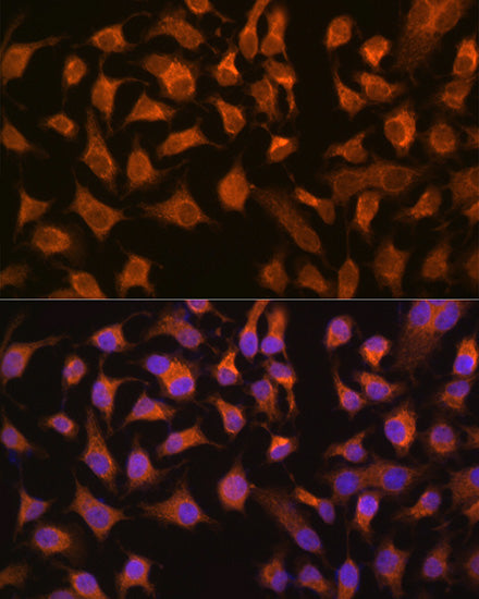 [KO Validated] PEPCK/PCK2 Rabbit mAb