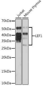 LEF1 Rabbit mAb