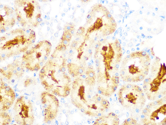 GCLC Rabbit mAb