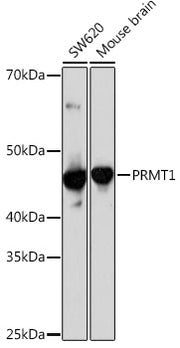 PRMT1 Rabbit mAb