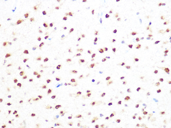 PRMT1 Rabbit mAb