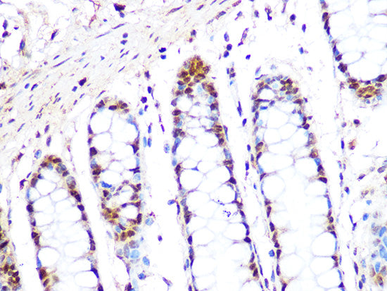 PRMT1 Rabbit mAb