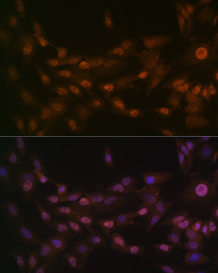 PRMT1 Rabbit mAb