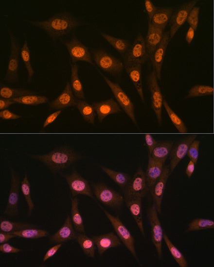 PRMT1 Rabbit mAb