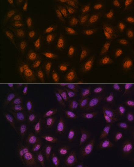 PRMT1 Rabbit mAb