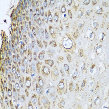 Prohibitin 2 (PHB2) Rabbit pAb