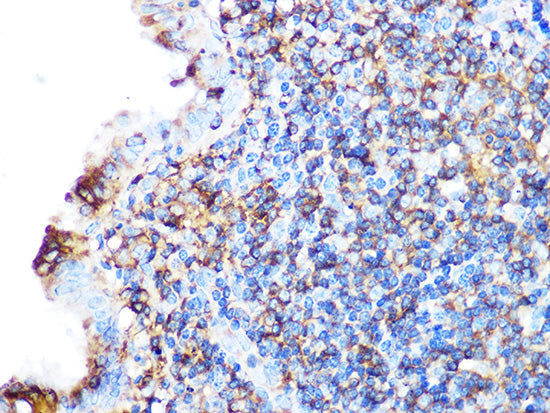 Arp3 Rabbit mAb
