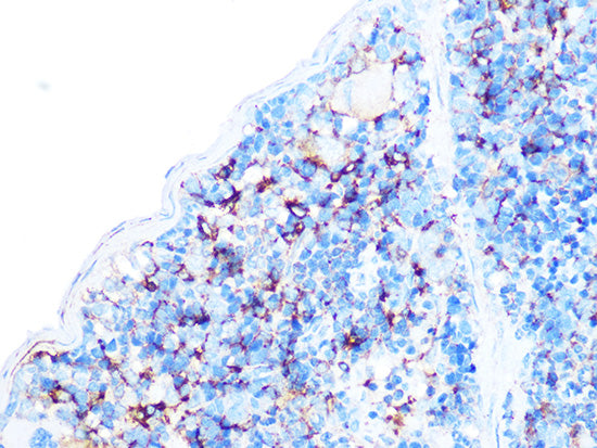 Arp3 Rabbit mAb