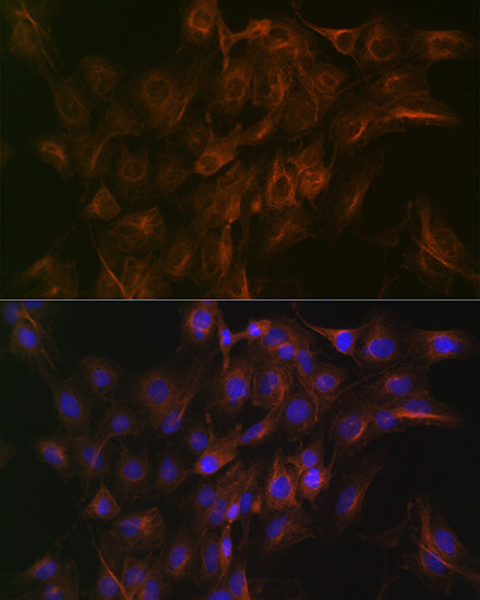 Arp3 Rabbit mAb