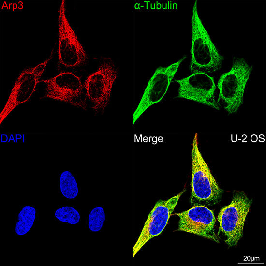 Arp3 Rabbit mAb