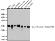 Casein Kinase 2 beta (CSNK2B) Rabbit mAb