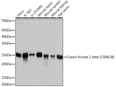 Casein Kinase 2 beta (CSNK2B) Rabbit mAb