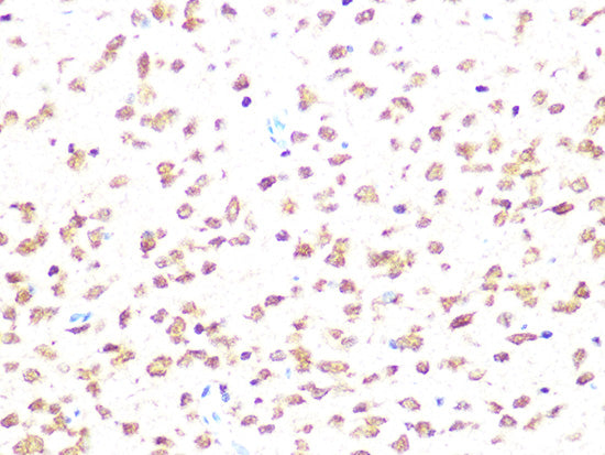 Casein Kinase 2 beta (CSNK2B) Rabbit mAb