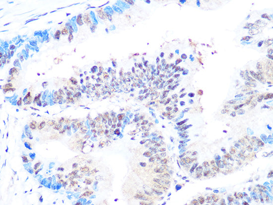 Casein Kinase 2 beta (CSNK2B) Rabbit mAb