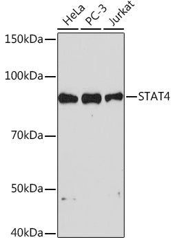 STAT4 Rabbit mAb