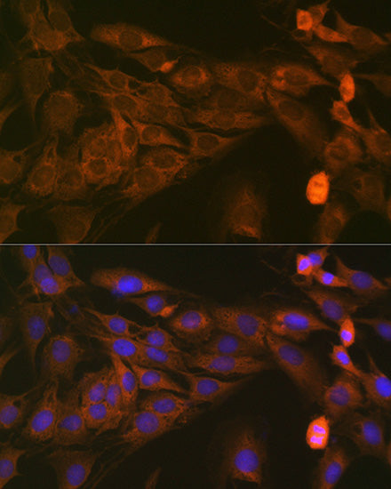 STAT4 Rabbit mAb