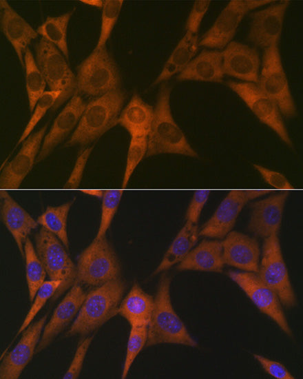 STAT4 Rabbit mAb