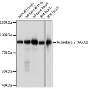 Aconitase 2 (ACO2) Rabbit mAb