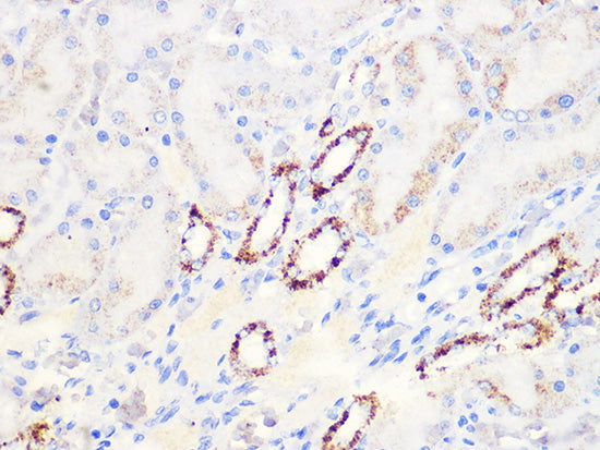 Aconitase 2 (ACO2) Rabbit mAb