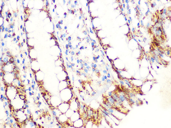 Aconitase 2 (ACO2) Rabbit mAb