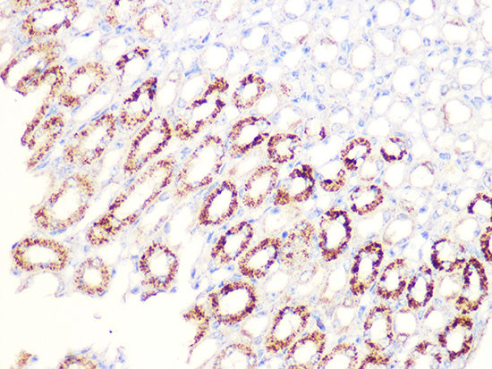 Aconitase 2 (ACO2) Rabbit mAb