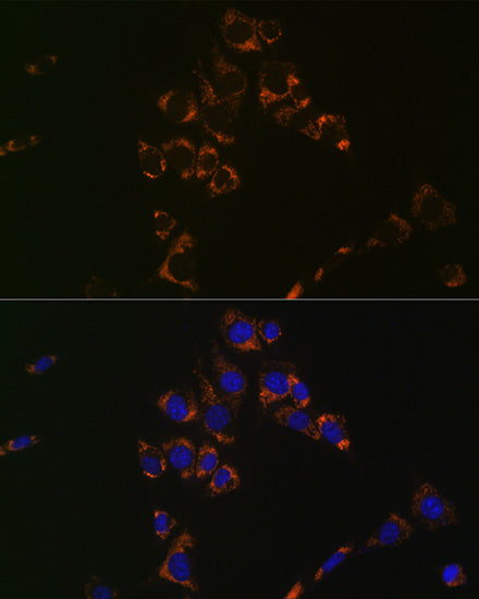 Aconitase 2 (ACO2) Rabbit mAb