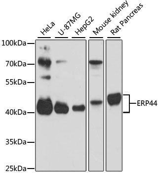 ERP44 Rabbit pAb