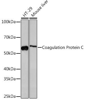Coagulation Protein C Rabbit mAb