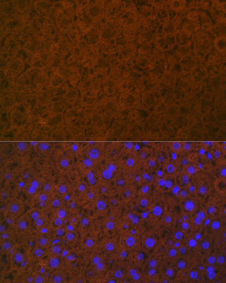 Coagulation Protein C Rabbit mAb