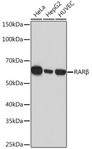 RARβ Rabbit mAb