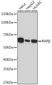 RARβ Rabbit mAb