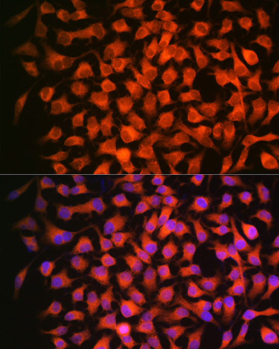 RARβ Rabbit mAb