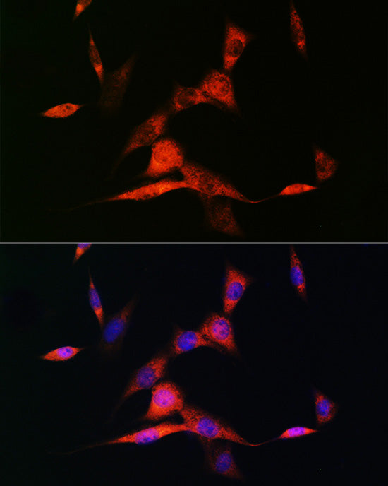RARβ Rabbit mAb